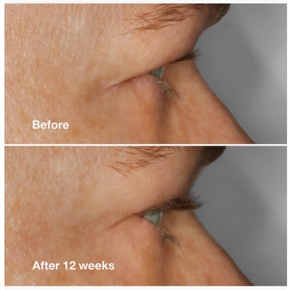 NWT Clinique HIGH IMPACT LASH SERUM 3ML - Picture 3 of 10